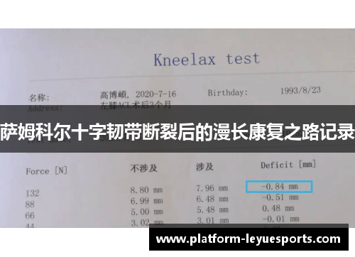萨姆科尔十字韧带断裂后的漫长康复之路记录 萨姆科尔十字韧带断裂后的漫长康复之路记录